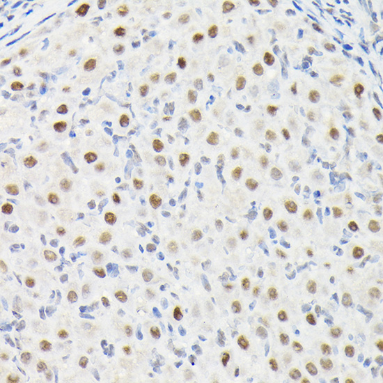 Anti-DYNLL1 Antibody (CAB14496)