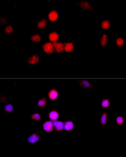 Anti-Cyclin A2 Antibody (CAB15036)