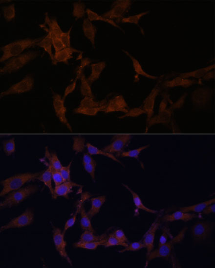 Anti-SERPINB9 Antibody (CAB6393)