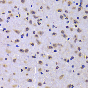 Anti-NUDC Antibody (CAB6678)