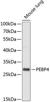 Anti-PEBP4 Antibody (CAB14485)