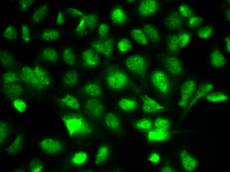 Anti-cIAP1 Antibody (CAB0866)