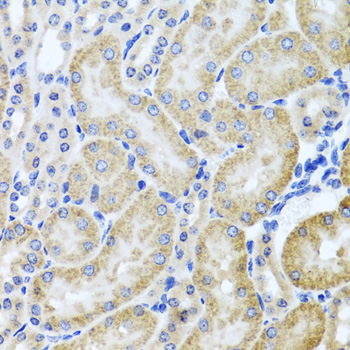 Anti-HDAC6 Antibody (CAB1732)