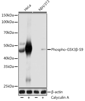 Anti-Phospho-GSK3Beta-S9 Antibody (CABP1088)