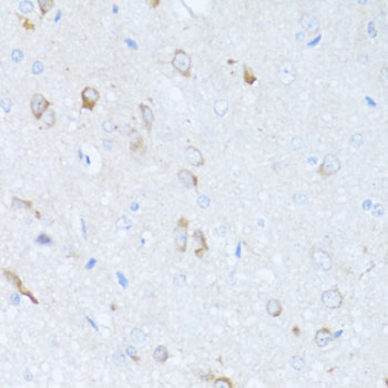 Anti-SERPINA3 Antibody (CAB2803)