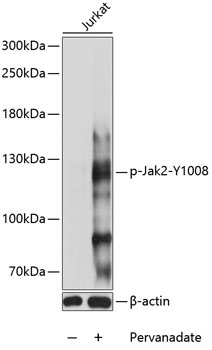 Anti-Phospho-Jak2-Y1008 pAb (CABP0772)