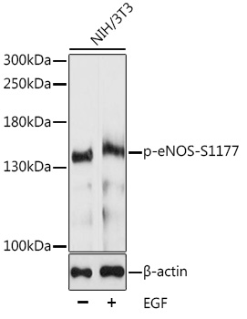 Anti-Phospho-eNOS-S1177 Antibody (CABP0515)