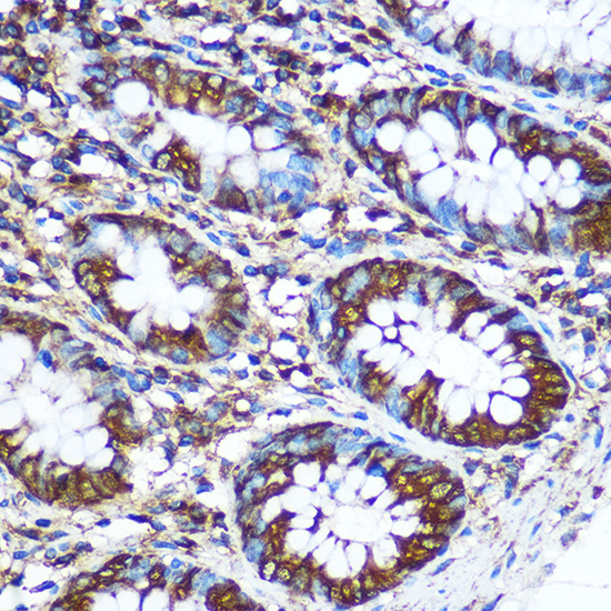 Anti-NME1 Antibody (CAB0259)