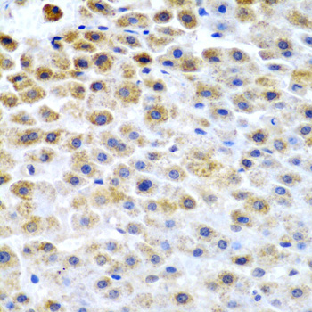 Anti-TFPI2 Antibody (CAB6214)