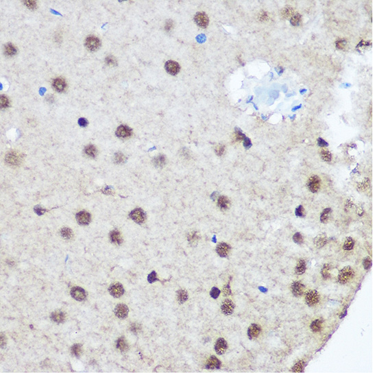 Anti-CTCF Antibody (CAB1133)