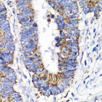 Anti-RALB Antibody (CAB4069)