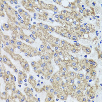 Anti-ACP1 Antibody (CAB1801)