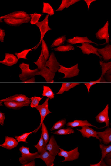 Anti-GCLM Antibody (CAB5314)