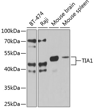 Anti-TIA1 Antibody (CAB12523)