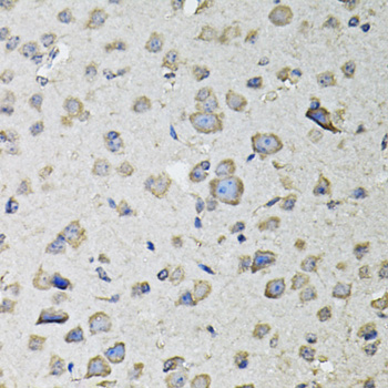 Anti-RASSF1 Antibody (CAB12567)