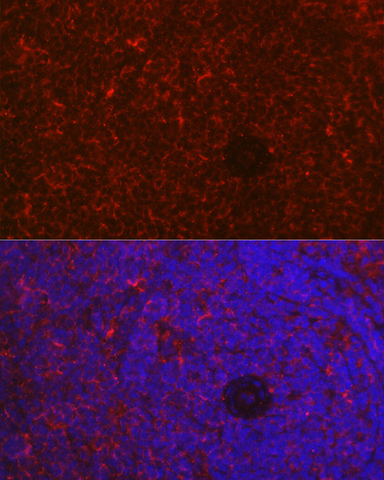 Anti-NFATC2 Antibody (CAB3107)