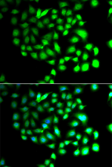 Anti-TCEAL8 Antibody (CAB7845)