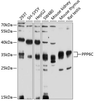 Anti-PPP6C Antibody (CAB4039)