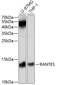 Anti-RANTES Antibody (CAB5630)