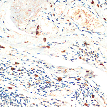Anti-FOXP3 Polyclonal Antibody (CAB8024)
