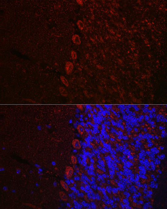 Anti-HCRTR1 Antibody (CAB14740)