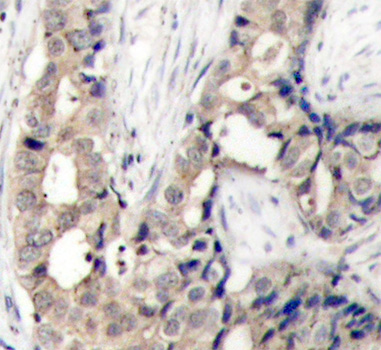 Anti-Phospho-ABL1-Y412 Antibody (CABP0303)