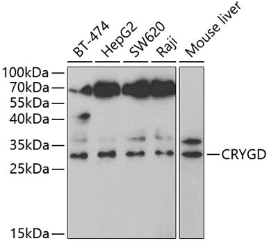 Anti-CRYGD Antibody (CAB5740)