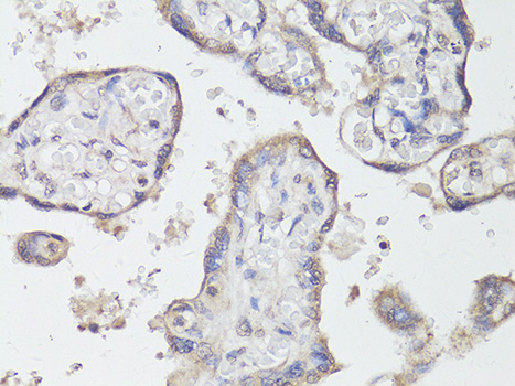 Anti-TrkB Antibody (CAB12011)