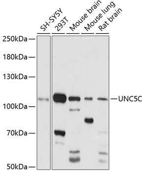 Anti-UNC5C Antibody (CAB14809)