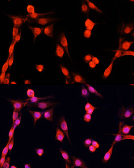 Anti-EGFR Antibody [KO Validated] (CAB11577)