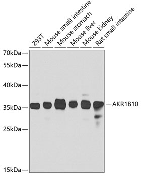 Anti-AKR1B10 Antibody (CAB7823)