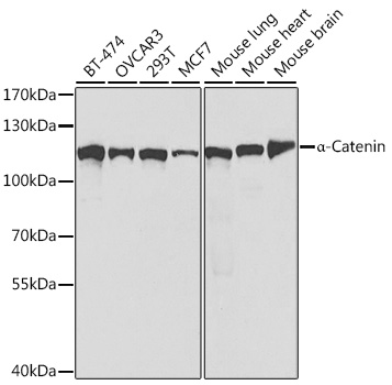 Anti-Alpha-Catenin Antibody [KO Validated] (CAB5635)