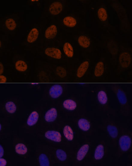 Anti-WDHD1 Antibody (CAB15396)