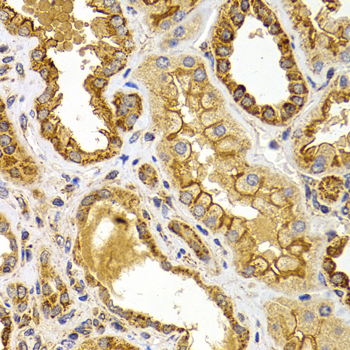 Anti-BMP15 Antibody (CAB7321)