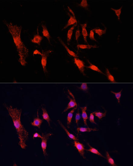 Anti-EGFR Antibody [KO Validated] (CAB11577)