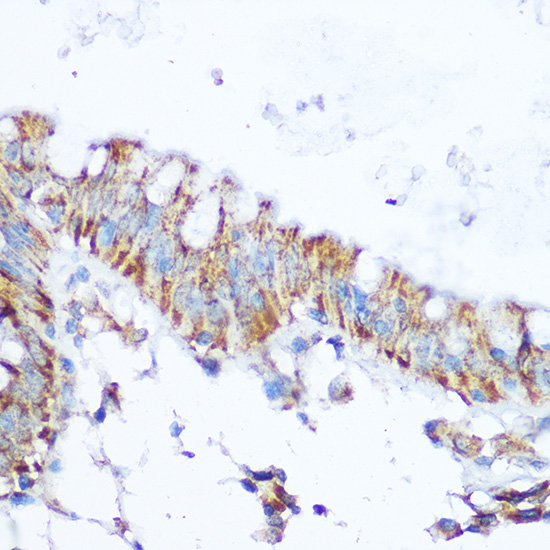 Anti-SIRT4 Antibody (CAB7585)