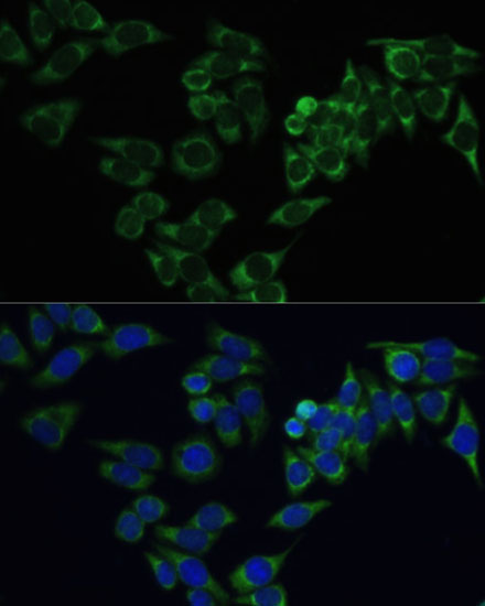 Anti-FSHR Antibody (CAB3172)