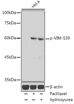 Anti-Phospho-VIM-S39 pAb (CABP0806)