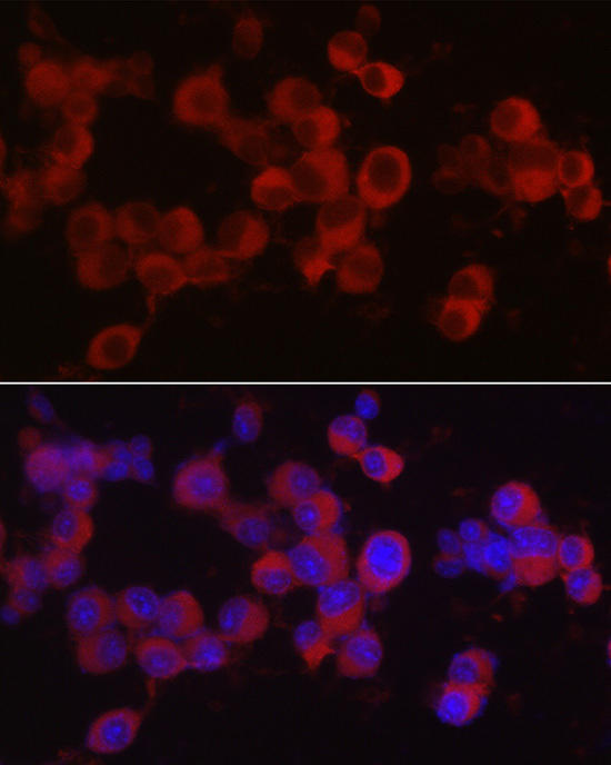 Immunofluorescence analysis of Neuro-2a cells using Ret Rabbit pAb at dilution of 1:50 (40x lens). Blue: DAPI for nuclear staining.