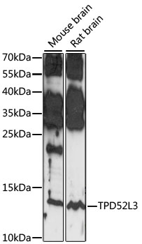 Anti-TPD52L3 Antibody (CAB15545)