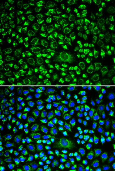 Anti-TAPBP Antibody (CAB13357)