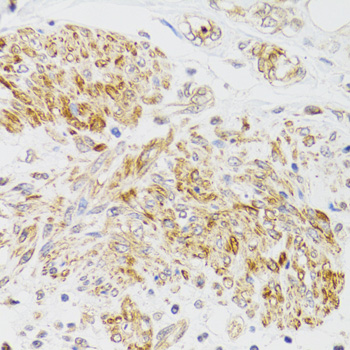 Anti-MYO5A Polyclonal Antibody (CAB9830)