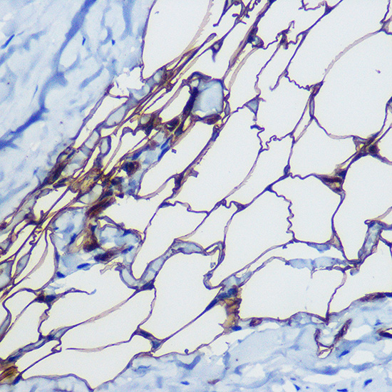 Anti-FABP4 Antibody (CAB0232)