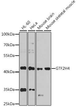 Anti-GTF2H4 Polyclonal Antibody (CAB8425)