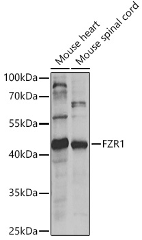 Anti-FZR1 Antibody (CAB5550)