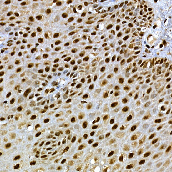 Immunohistochemistry of paraffin-embedded human esophagus using SCAF4 Rabbit pAb at dilution of 1:50 (40x lens). Perform high pressure antigen retrieval with 10 mM citrate buffer pH 6. 0 before commencing with IHC staining protocol.