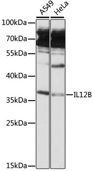 Anti-IL-12B Antibody (CAB13024)