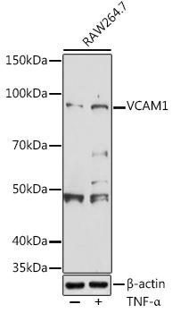 Western blot analysis of extracts of RAW264. 7 cells, using VCAM1 antibody at 1:500 dilution. RAW264. 7 cells were treated by TNF-Î± (20 ng/ml) at 37â„ƒ for 16 hours after serum-starvation overnight. Secondary antibody: HRP Goat Anti-Rabbit IgG (H+L) at 1:10000 dilution. Lysates/proteins: 25ug per lane. Blocking buffer: 3% nonfat dry milk in TBST. Detection: ECL Basic Kit. Exposure time: 180s.