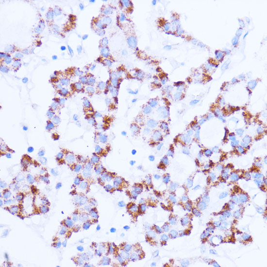 Anti-SIRT3 Antibody [KO Validated] (CAB5718)