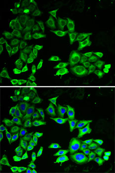 Anti-AMPKAlpha1 Antibody (CAB1229)